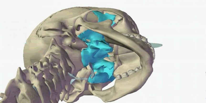 Mouvement craniosacrale